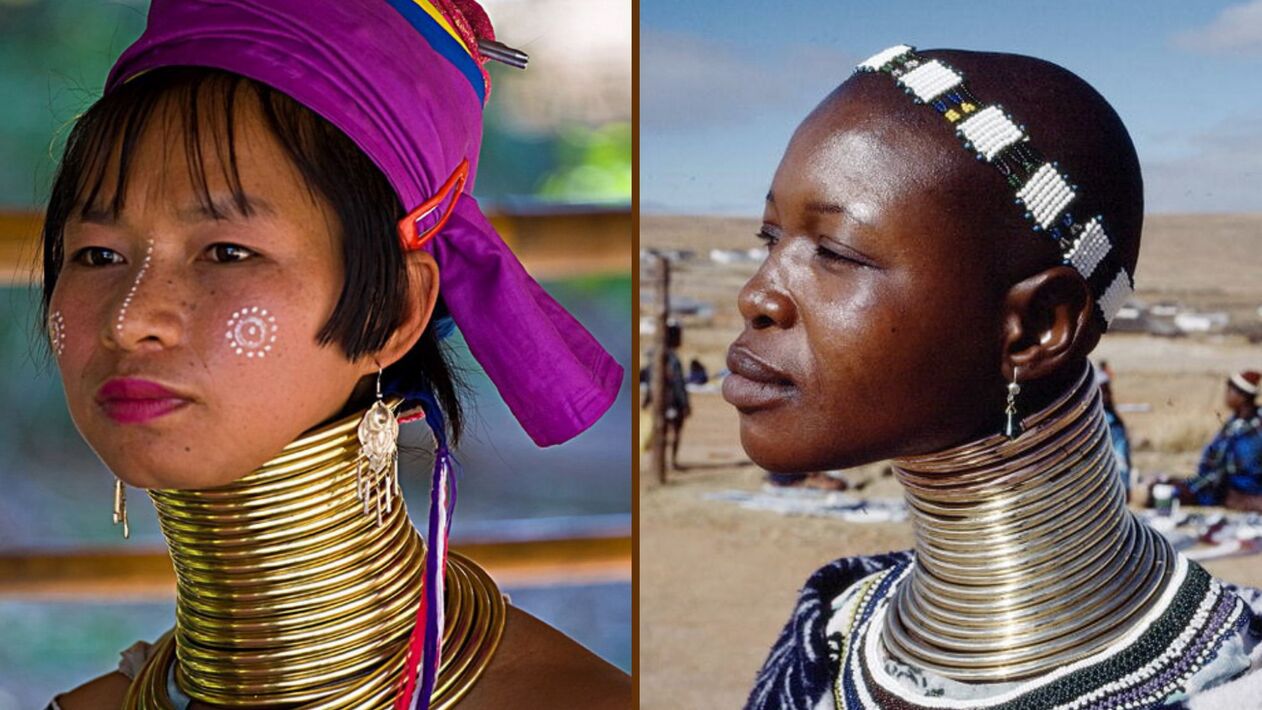 Επιμήκυνση του λαιμού σε γυναίκες της αφρικανικής φυλής